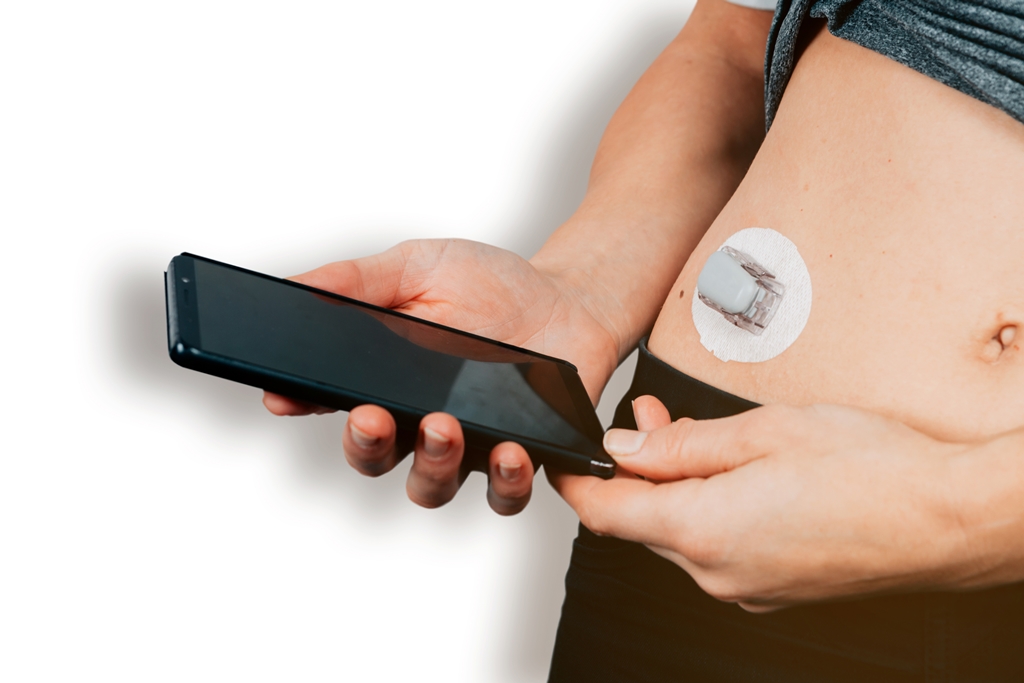 Continue glucose monitoring sensor diabetes