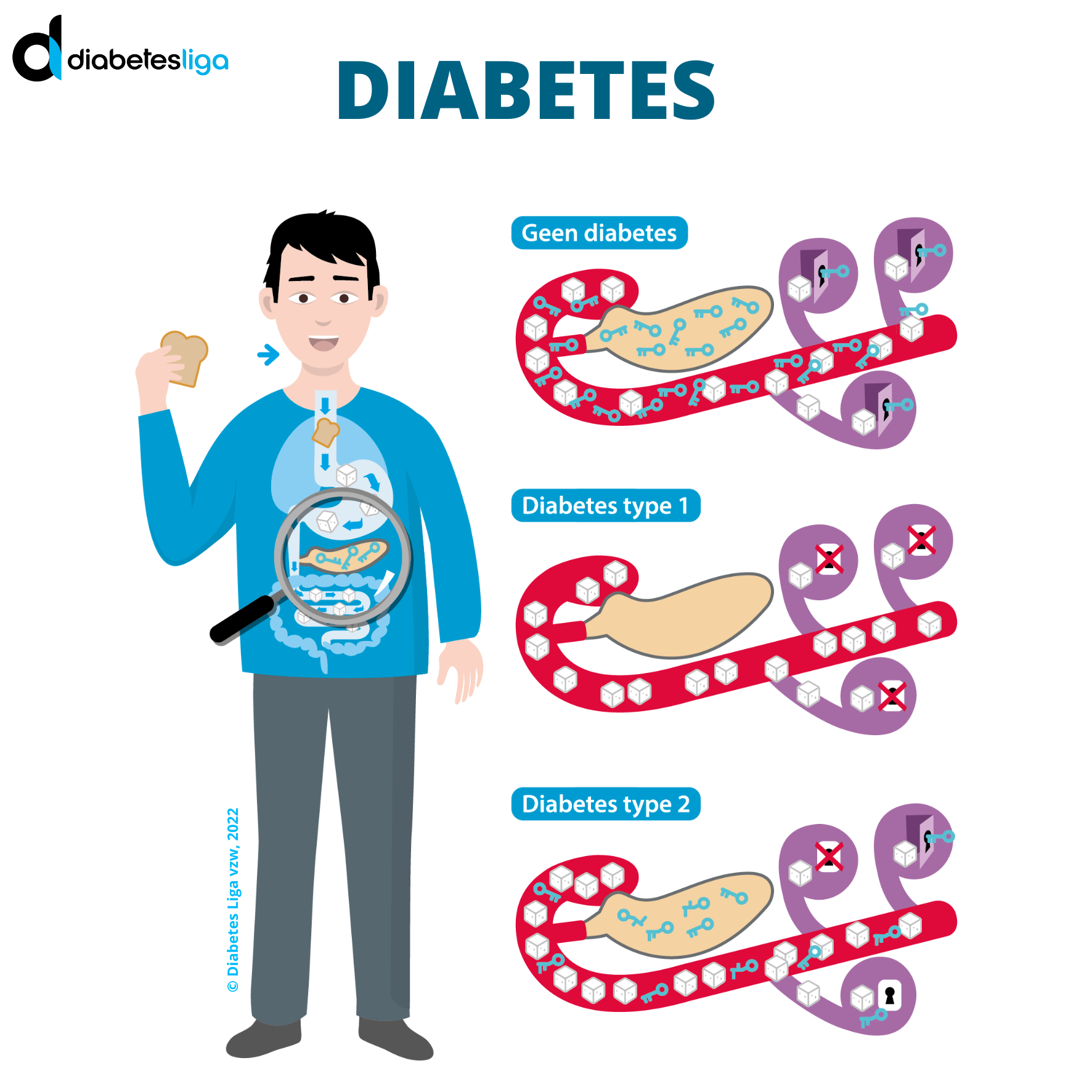 Visual verschillende types diabetes met logo Diabetes Liga