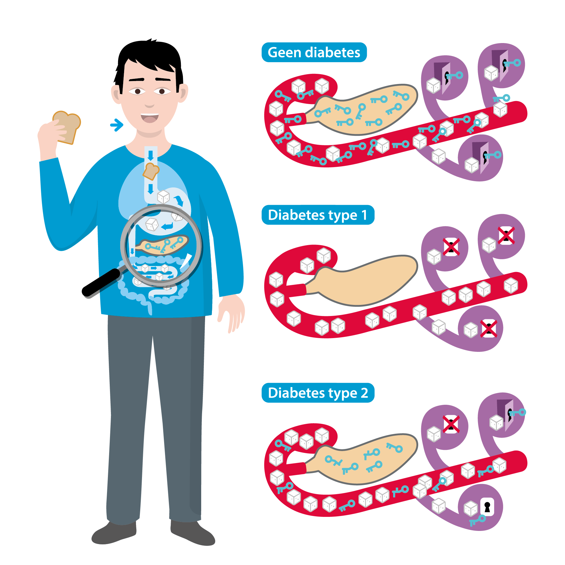 Verschillende types diabetes